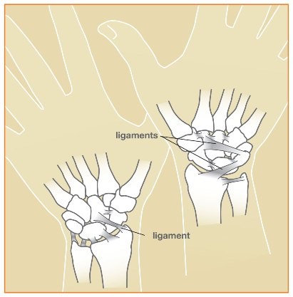 Wristsprains_image1